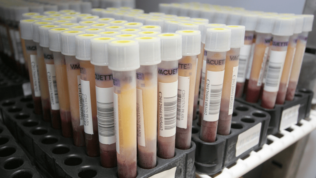 Zkumavky se vzorky krve v laboratoři transfuzního oddělení